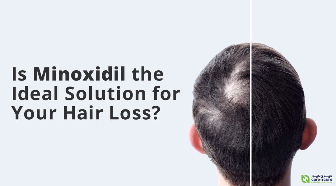 Minoxidil Hair Care Solution