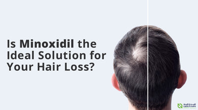 Is Minoxidil the Ideal Solution for Your Hair Loss?