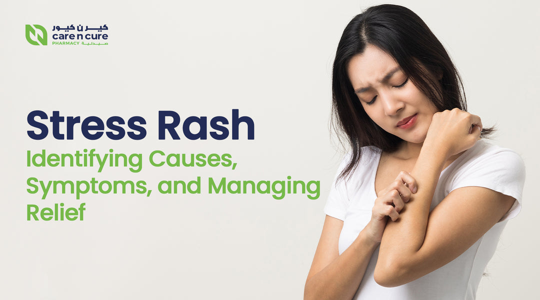 Stress Rash: Identifying Causes, Symptoms, and Managing Relief