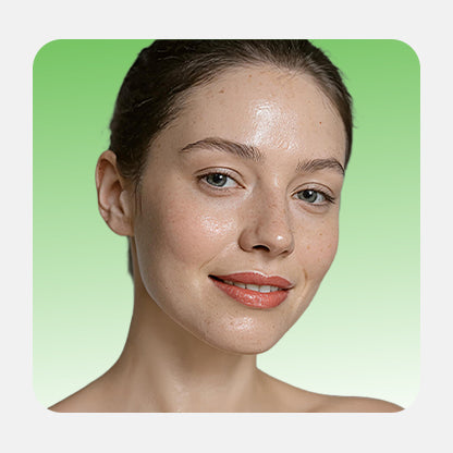 Oily skin Solutions