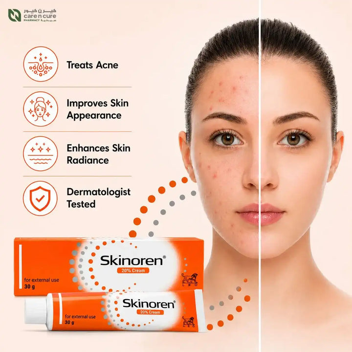 Skinoren Cream 30 g tube and box shown alongside a split-face graphic of a woman with and without acne, plus text listing benefits: treats acne, improves skin appearance, enhances skin radiance, and is dermatologist tested.