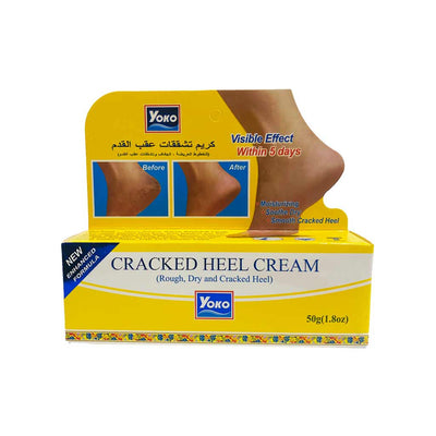 Yoko Cracked Heel Cream-50gm- Y432